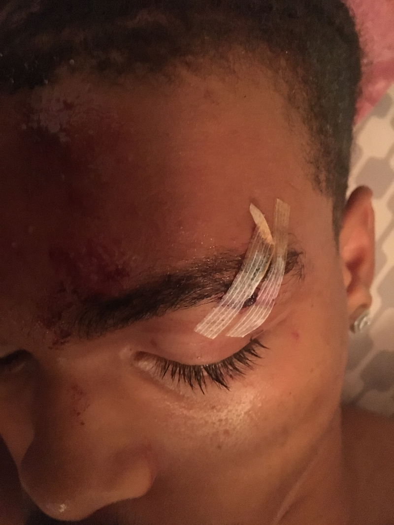 Illustration for article titled Interview: 20-Year-Old Deandre Harris Speaks Out About Being Assaulted by White Supremacists in Charlottesville, Va.